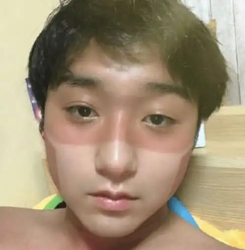 皮肤晒黑了怎么快速白回来一次性告诉你快速白回来的全部方法