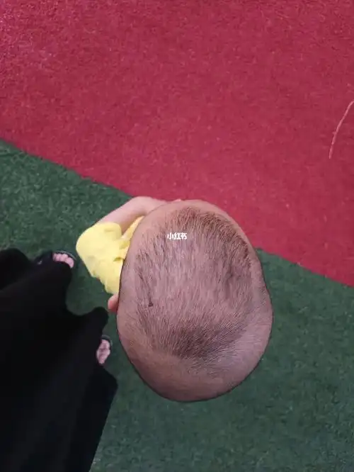 宝宝头型  一岁九个月了,还有救嘛9595