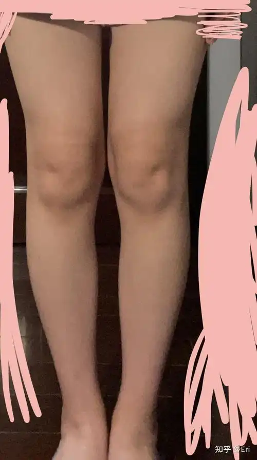 大腿围51如图请问这样的腿粗吗