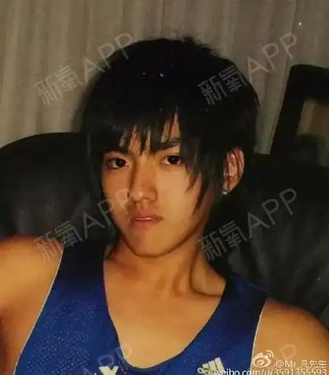 (反颌矫正前后对比) 吴亦凡的下颌骨符合上述说的.