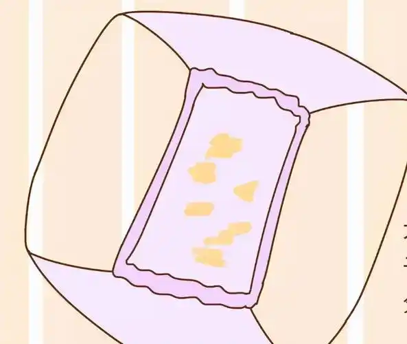 为啥女性内裤上总有黄色分泌物是什么原因呢