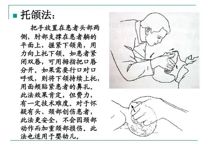 无忧文档 所有分类 高等教育 理学 心肺复苏课件ppt 托颌法: 把手放臵