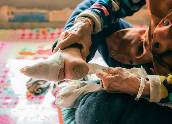 使用长布条缠裹小脚.使用线绳将缠裹在小脚上的长布条上进行牢固.