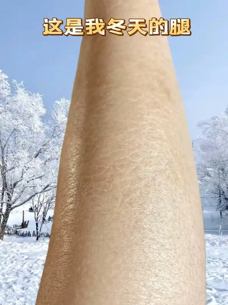 皮肤干燥又粗糙!显老20岁!简直是糙皮救星!滑 - 抖音