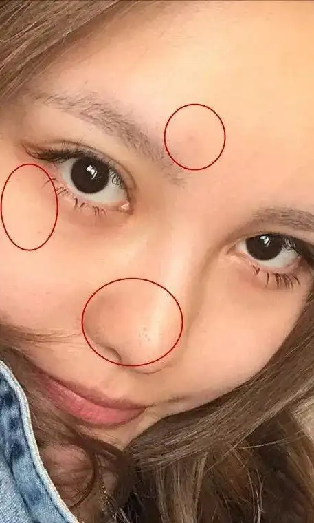 女明星素颜照不堪入目?正确去黑头,粉刺,肌肤看起来年轻五岁!