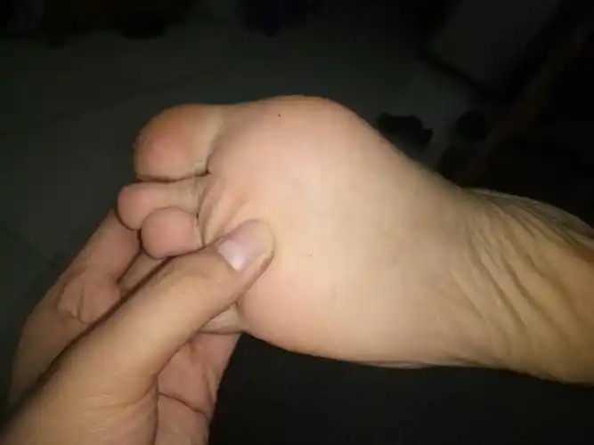 脚斜方肌里面的骨头突出是怎么回事在哪