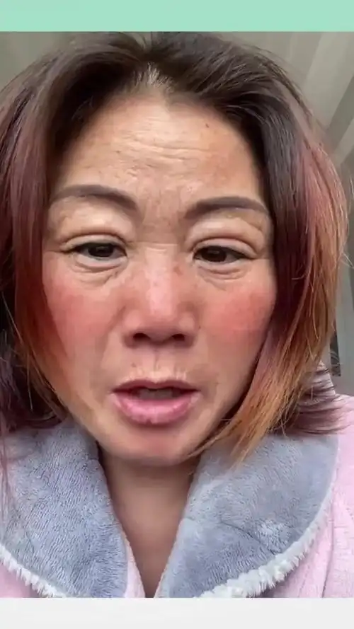 见识下整容失败的下场,这样一张脸,把我看愣住了!