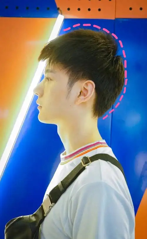 侧面看还挺明显的,颅顶高