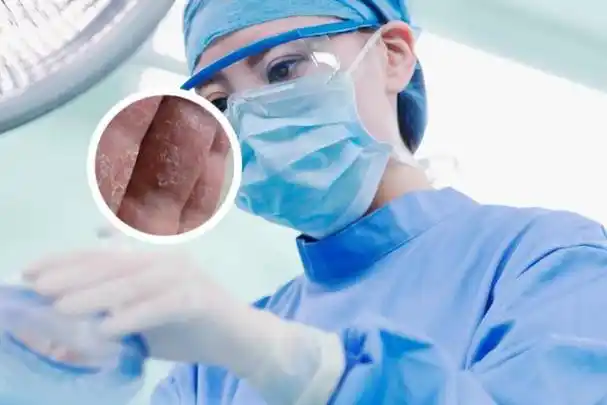 皮肤科(银屑病/牛皮癣)医生免费问诊