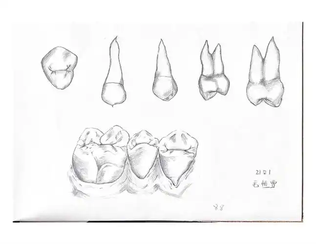 牙体素描照片_page-0007.jpg