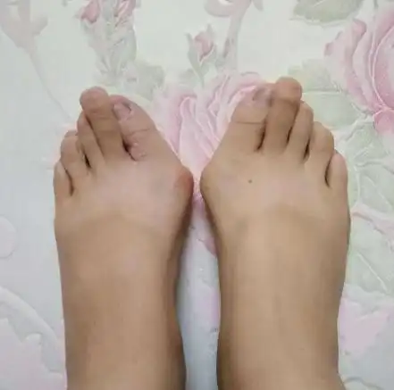 第二个脚趾长是什么命?