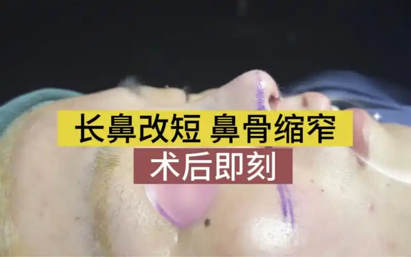 神奇的"变脸术",一秒长脸变短,只因为她动了一下鼻子?