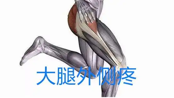 大腿外侧痛如何缓解