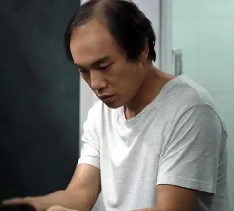 隐秘的角落张东升为什么秃头