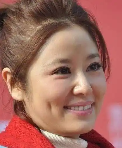 44岁林心如严重脱发?