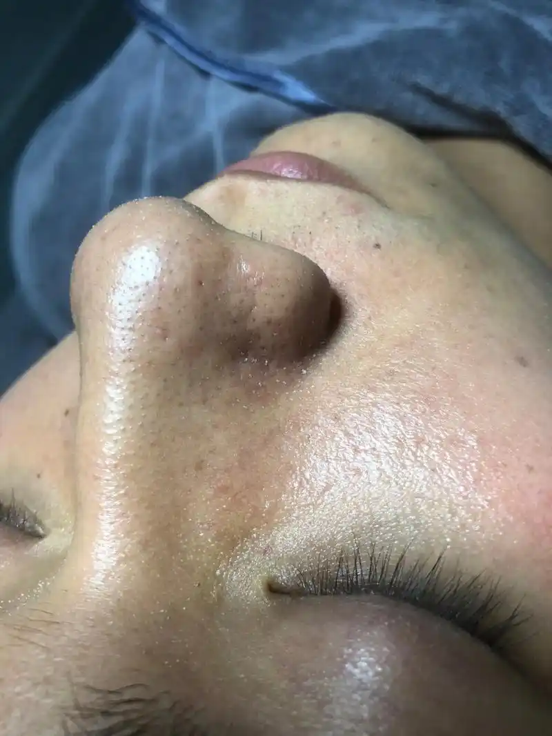 男士护肤 男人不需要多帅 但是一定要干净,清洁毛孔污垢黑头 - 抖音