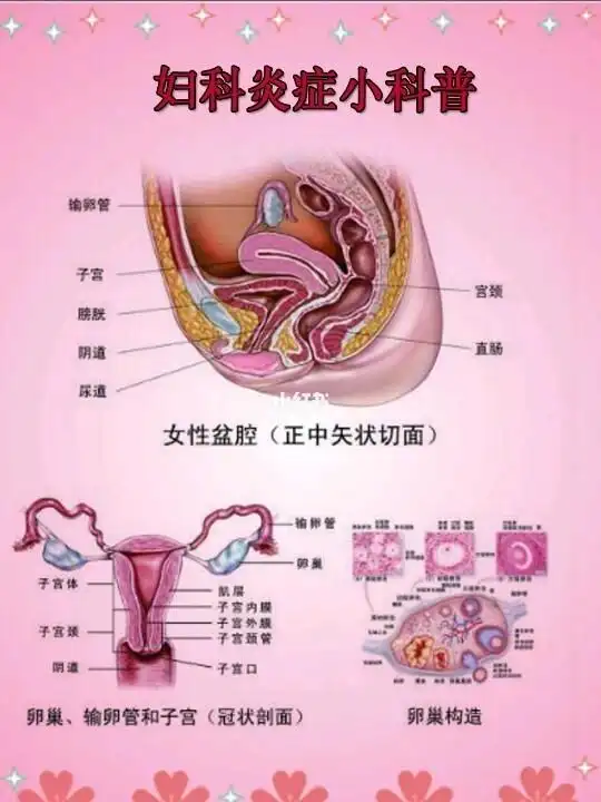 不做炎女人妇科炎症小解读