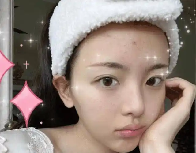 杨超越分享素颜自拍照脸部长痘略有瑕疵脸部线条清晰可见