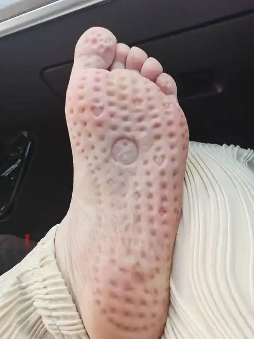 坚持按摩脚心帮你去除百病