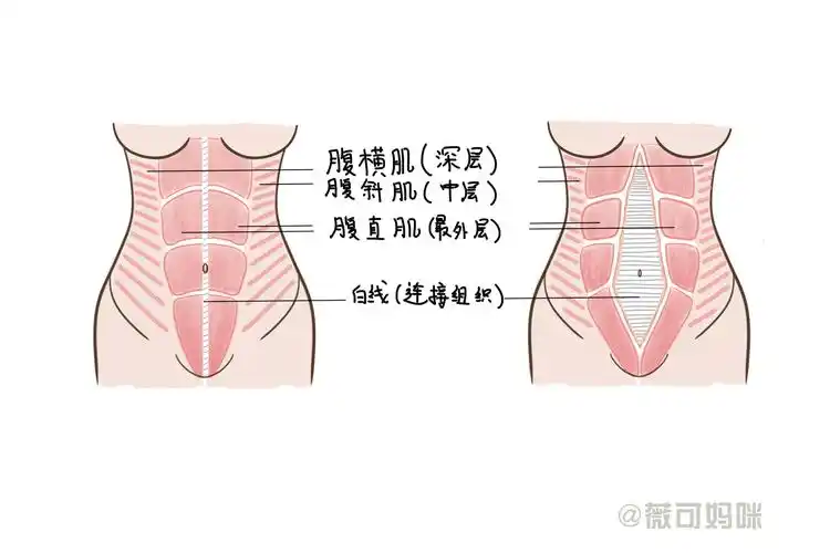 为什么生完孩子一年了,肚子还有一层"游泳圈"?