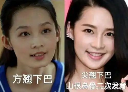 李沁庆余年里变脸,看前后对比图