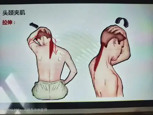 头颈夹肌及手法.
