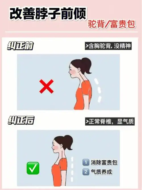 6个动作改善脖子前倾60气质养成记