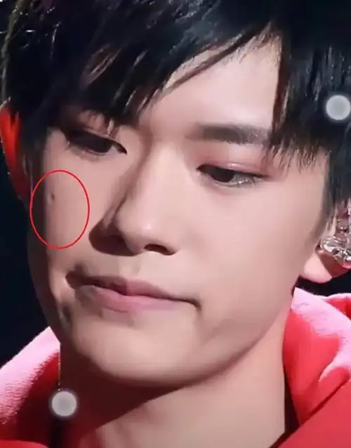 易烊千玺脸上除了痘痘还有"它",看到高清图后网友:暴露颜值