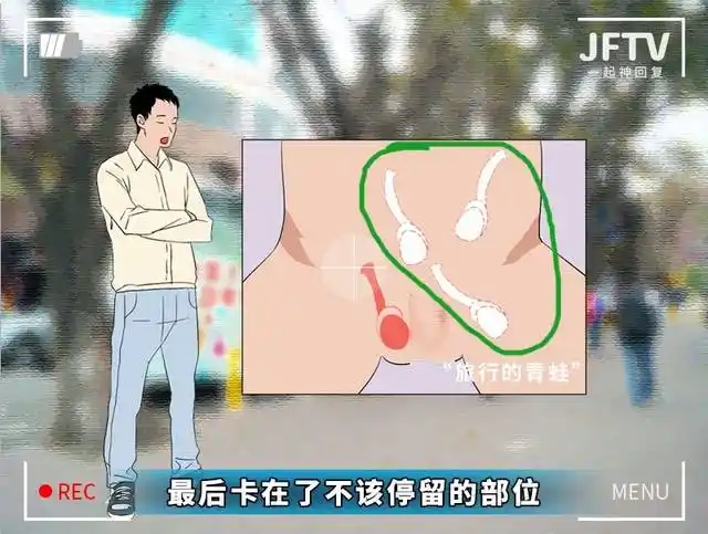 当它们觉得冷时,会自然向身体贴近,当你发烧时,蛋蛋又会躲远(下垂)给