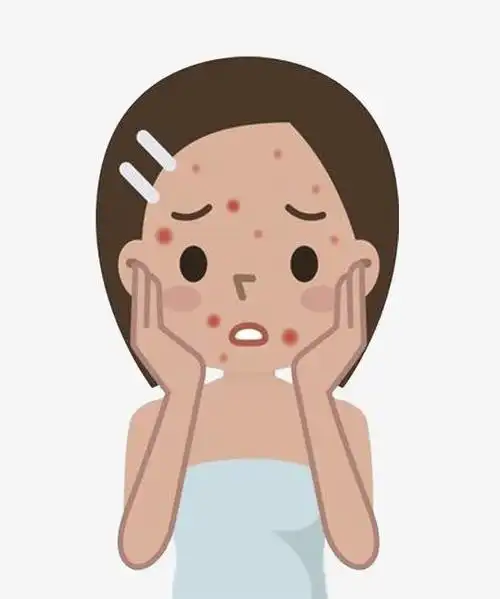 合肥肤康饮食不合理而长痘痘给你一张痘痘痤疮忌口食物清单