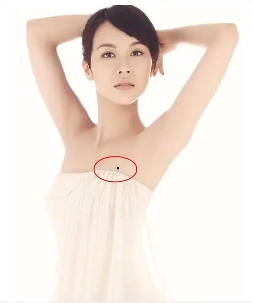 一个痣比一个好这几个痣暗示你的财富值你有吗