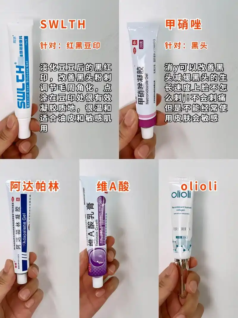 祛痘药膏合集测评!