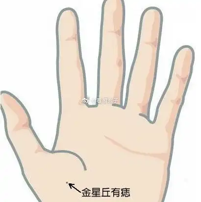 金星丘有痣的女人,富贵是缘由爱情,也就是会嫁一个非富即贵或者是潜力