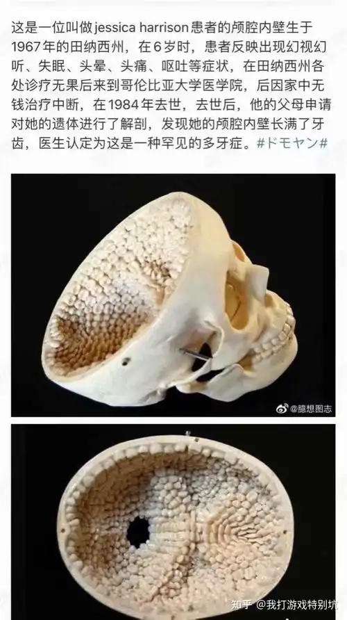 有哪些密集恐惧症的人看了会头皮发麻的图片