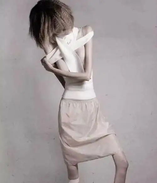 世界最瘦的人只有22公斤的女孩ariel