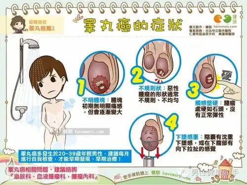 硬如石?睾丸癌"4大症状"
