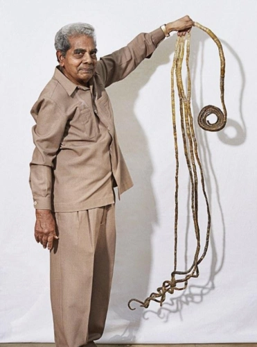 世界上指甲最长的人,62年不剪指甲总长9米