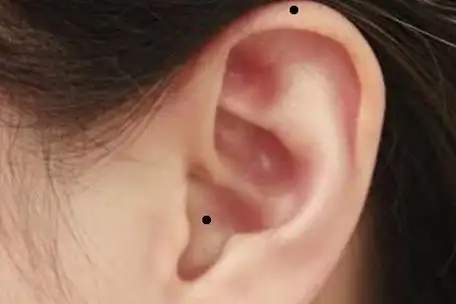 耳朵痣相命运好不好