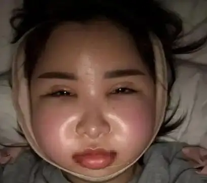 21岁女孩整容死亡直送殡仪馆,整容丢了命,花季殒命不值