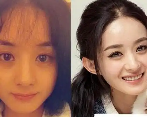 原来可爱的小骨以前也是胖子一个,网友纷纷称赵丽颖整容前后对比照差