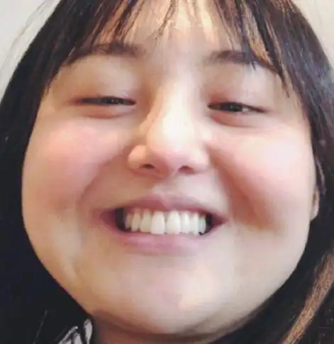 我们长大了嘉宾集体发丑照傅菁挤出双下巴郑爽大饼脸