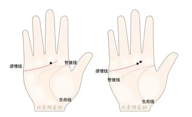 掌中有痣的人,会有怎样的性格和命运?