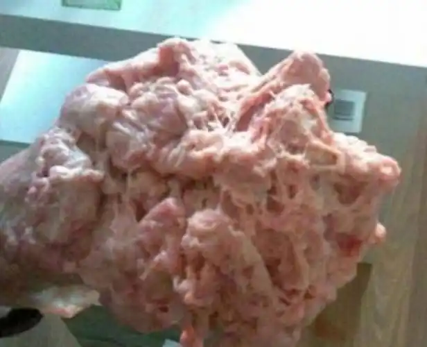 取出用凉水洗无数次,一定要把里面的血冼干净为止,处理后的胎盘是白色