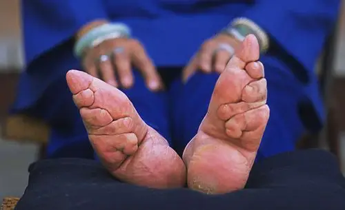 69 官方圈子 69 港深珠澳摄影圈 69 走进中国最后一代裹脚的