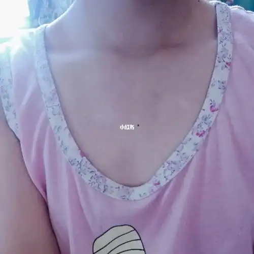 胸前痣有什么说法吗