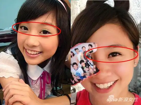 又一位女星承认微整 鬼鬼吴映洁定期打肉毒|吴映洁|鬼鬼|整容_新浪