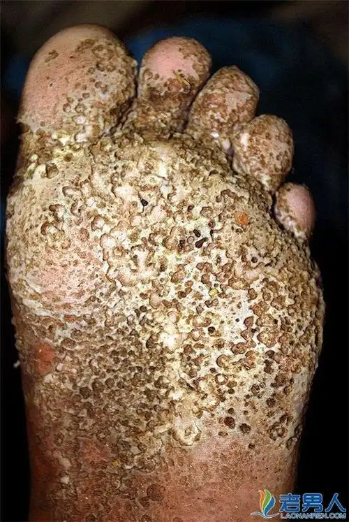 10张超密集恐惧症的测试图,如果看了你会感到莫名其妙的恐惧和厌恶,你