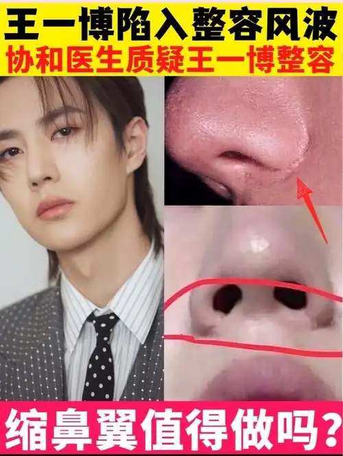 王一博被质疑整容换头02