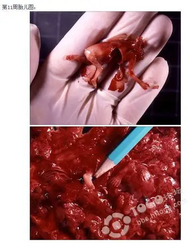 做药流清宫一个月零六天了,月经还没来,会不会有什么