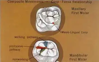 在前伸合时,上颌第一磨牙近中舌尖,会沿着中央沟向远中滑动